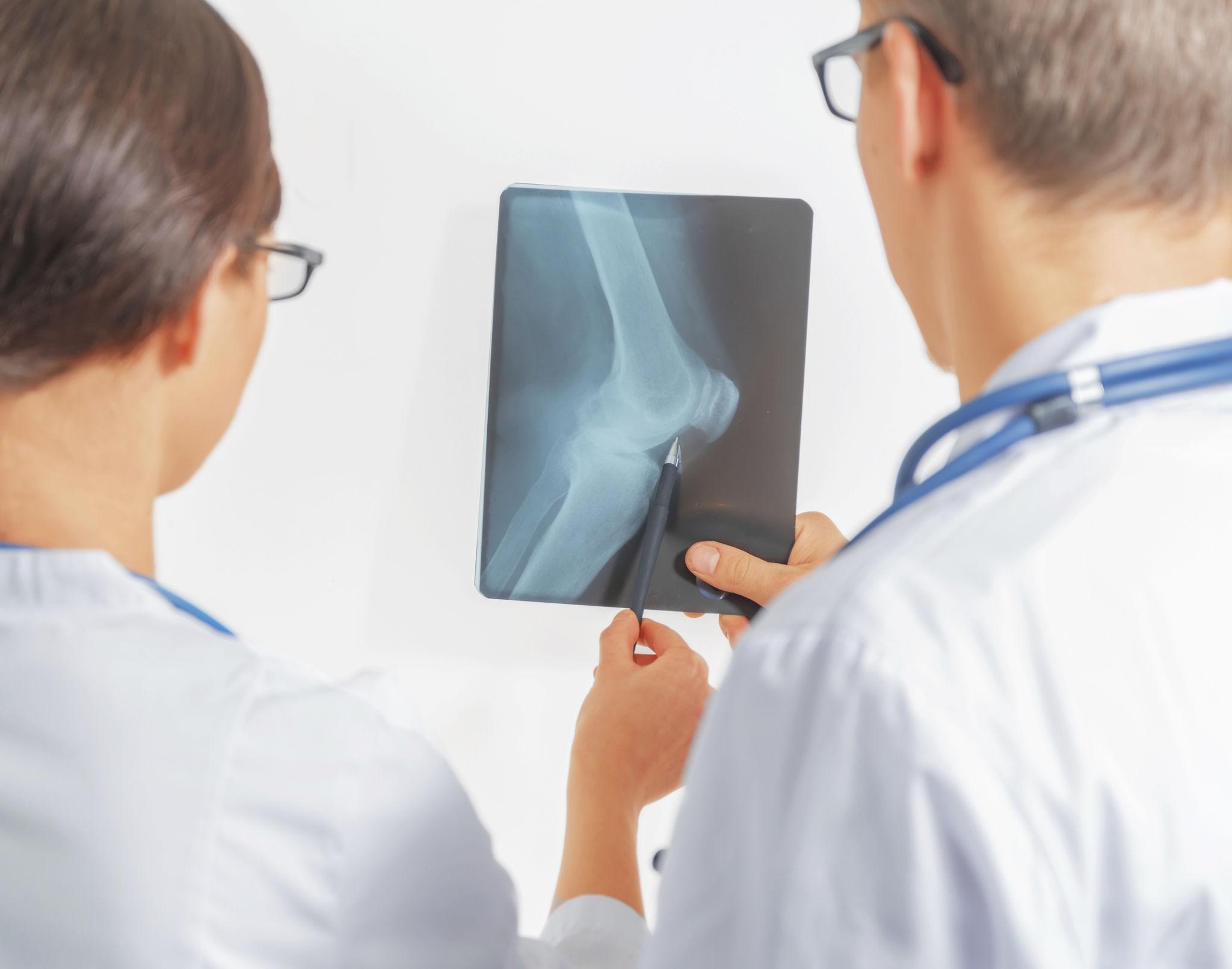 3D Conformal Radiation Therapy mapping interface